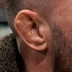 Why is Conor McGregor's Ear Like That? | Easily Explained